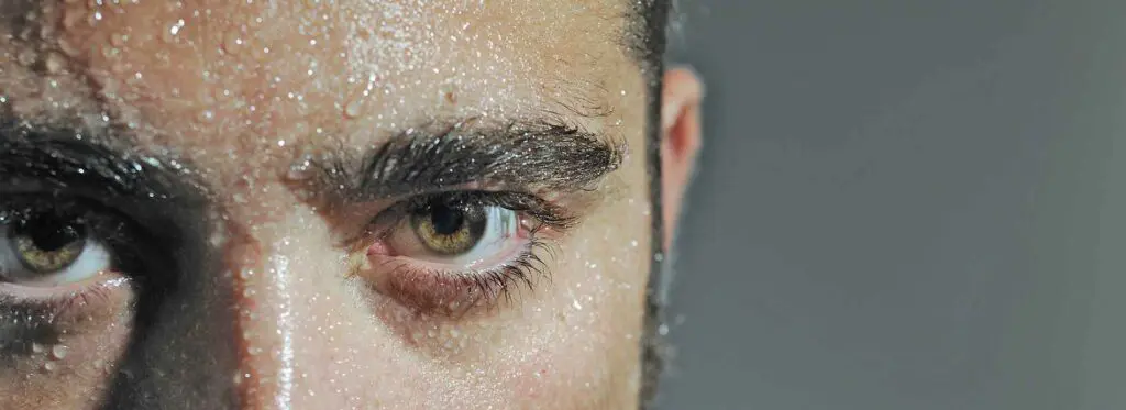 excessive sweating treatment in New Jersey