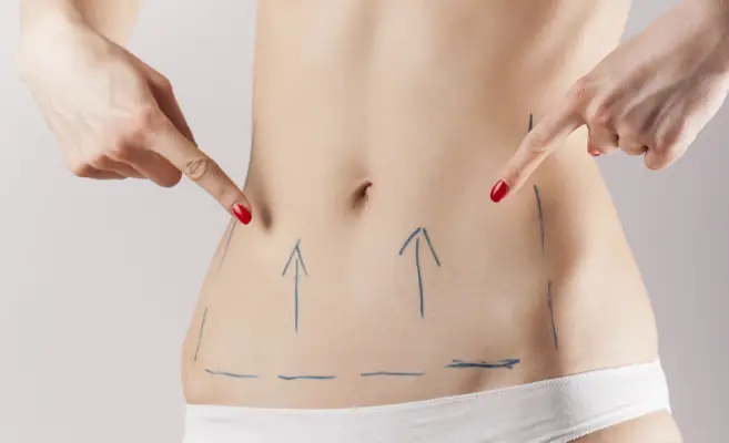 5 Facts About the Fat Transfer Procedure in Fat Transfer.