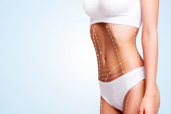 What to Expect from Liposuction Procedures in Liposuction.