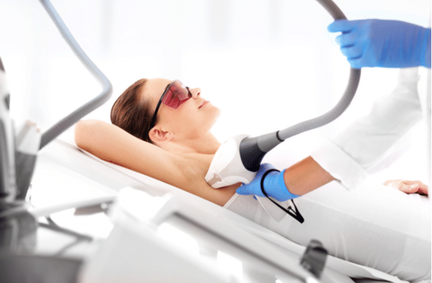 3 Myths About Laser Hair Removal