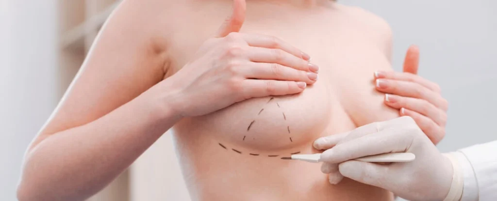 Breast Augmentation in New Jersey