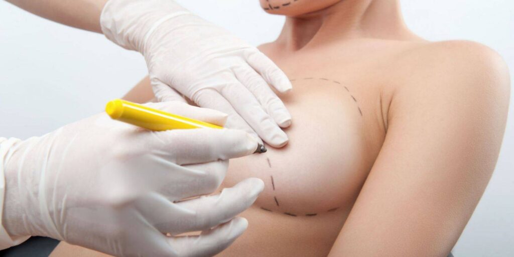 breast reduction consultation in NJ