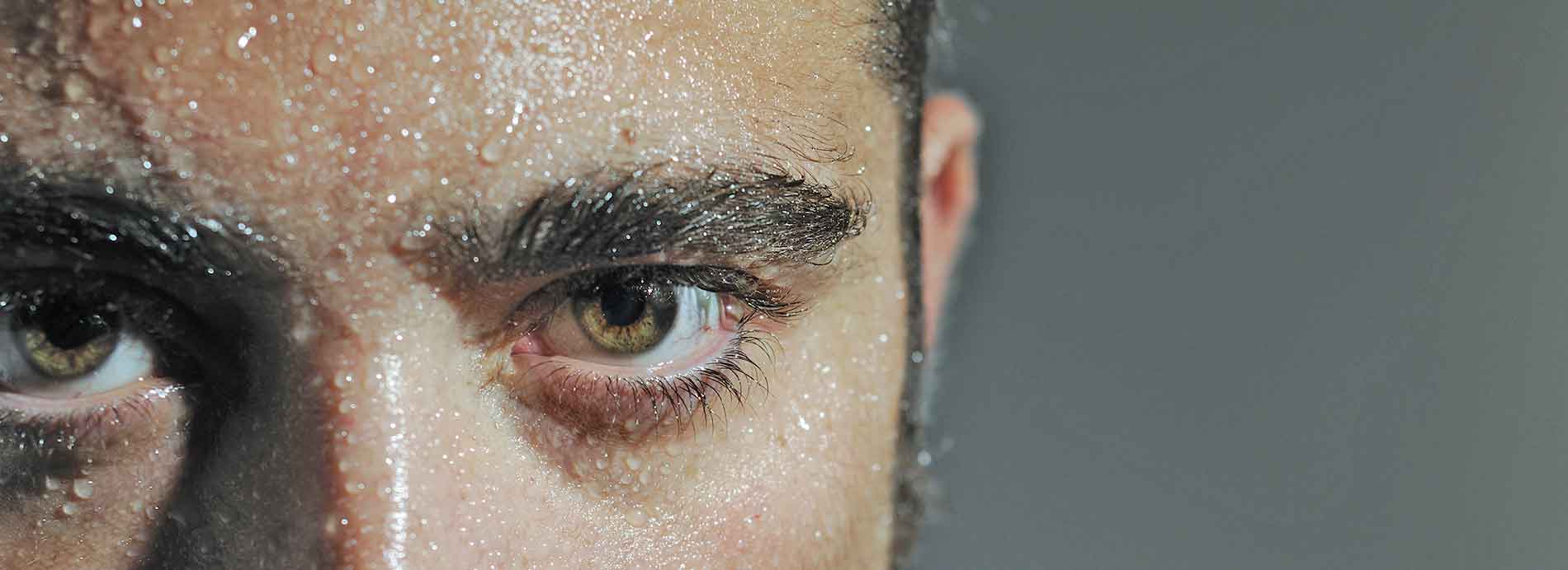 excessive sweating treatment in New Jersey