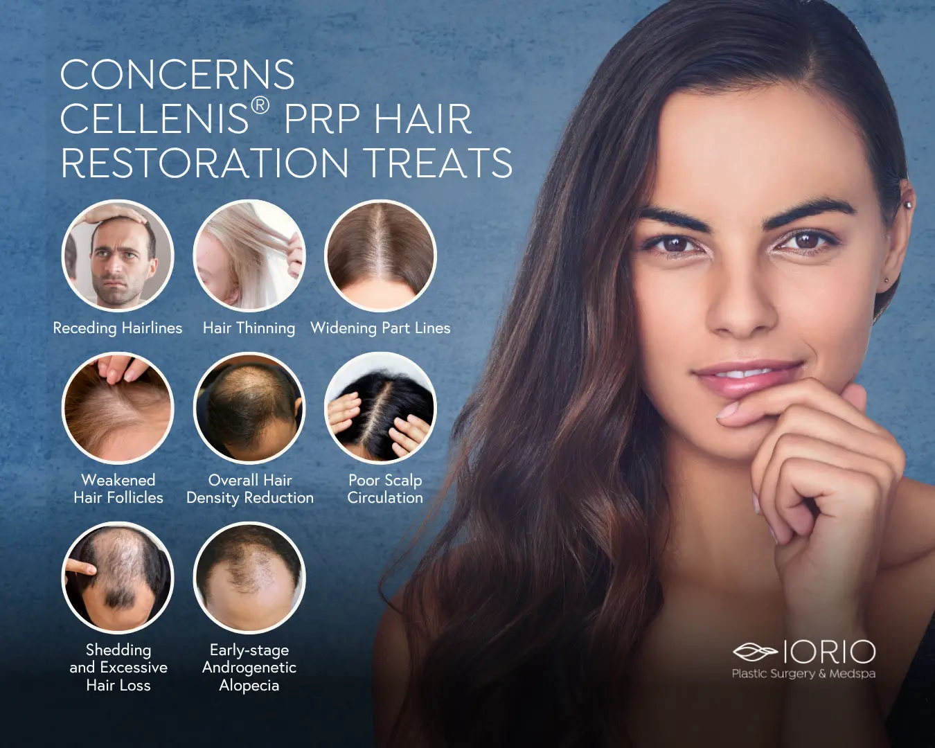 Cellenis PRP for Hair Restoration in NJ | Iorio Plastic Surgery